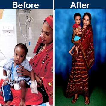 before-after-mohamad