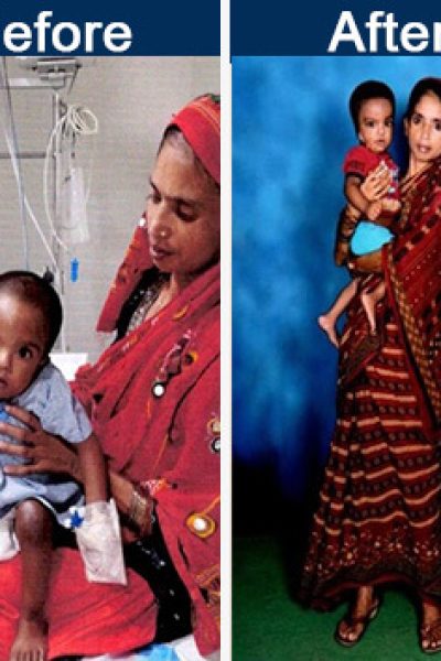 before-after-mohamad